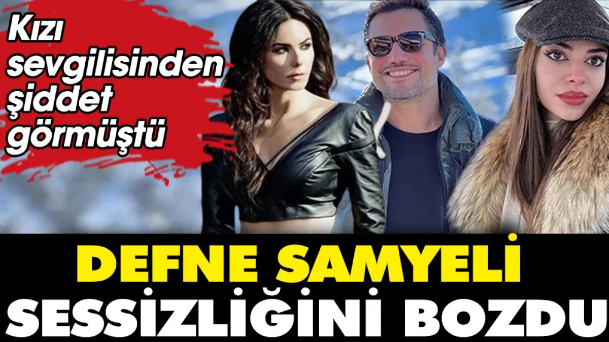 Defne Samyeli: Kızım Derin sevgilisi tarafından darp edildi